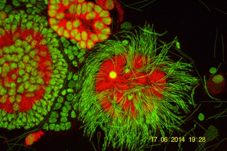 Spermatogoni e spermi in lombricus - A.A.