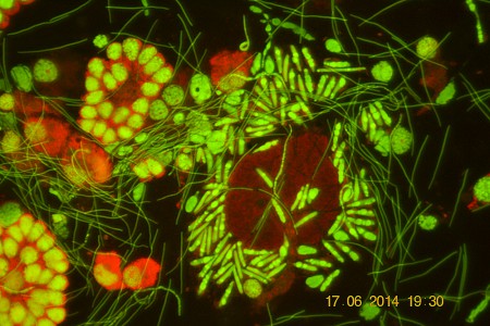 Sermatogoni, Spermatociti, Spermatidi e spermi in lombricus  A.A.